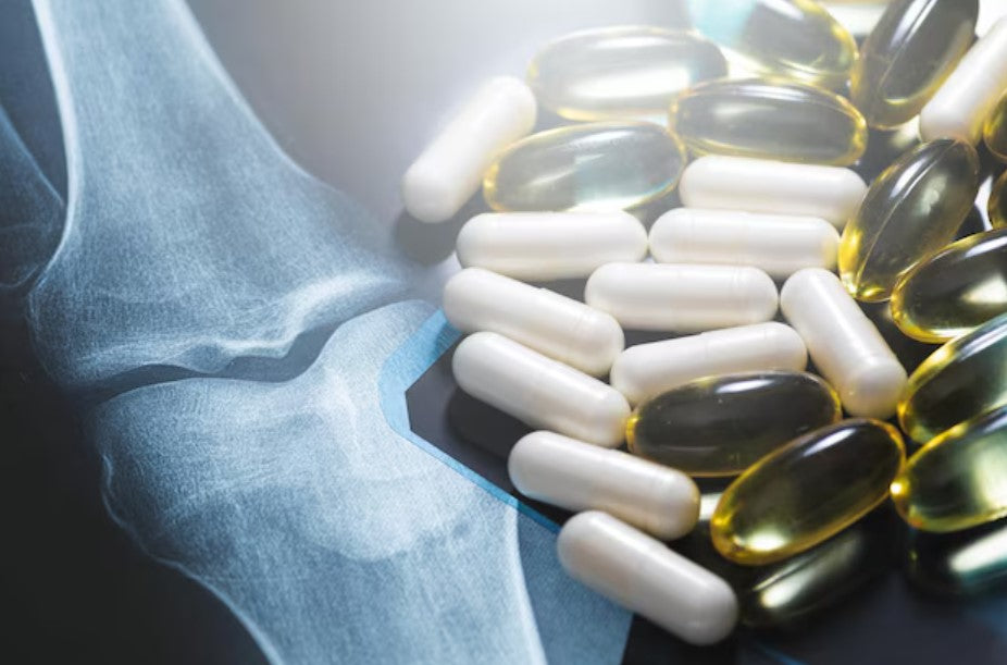 Muévete sin molestias: lo que debes saber sobre suplementos para articulaciones y huesos